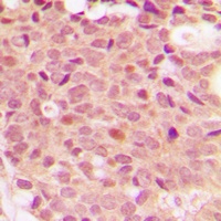 Anti-Histone Deacetylase 5 (Phospho-S498) Antibody