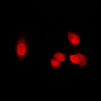 HDAC5 (phospho-S498) antibody