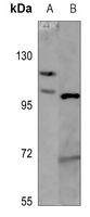 Histone Deacetylase 5 Antibody