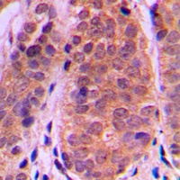 Histone Deacetylase 5 Antibody