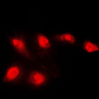 Histone Deacetylase 5 Antibody