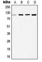 Histone Deacetylase 5 Rabbit Polyclonal Antibody