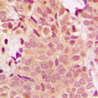Histone Deacetylase 5 Rabbit Polyclonal Antibody