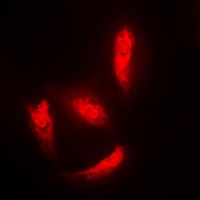 Histone Deacetylase 5 Rabbit Polyclonal Antibody
