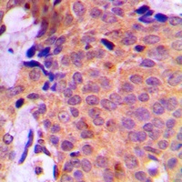 UBA2 Antibody