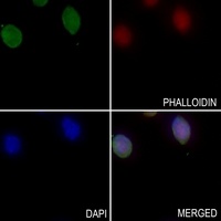 Anti-FARSB Antibody