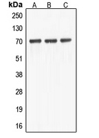ABCF2 Rabbit Polyclonal Antibody