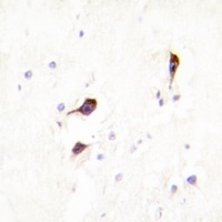 Anti-Cyclophilin F Antibody