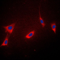 Anti-Cyclophilin F Antibody