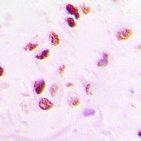 Anti-RAD50 Antibody