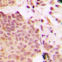 Anti-G3BP1 (Phospho-S232) Antibody