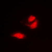 Anti-G3BP1 Antibody