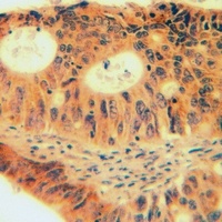 Anti-CAPRI Antibody