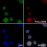 Anti-AASS Antibody