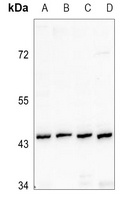 Renin Receptor Antibody