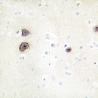 ATP6AP2 antibody