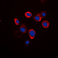 Anti-Renin Receptor Antibody