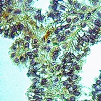 Anti-MPP9 Antibody