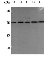 DHRS2 Antibody