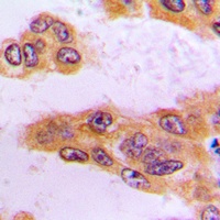 Anti-BCKDK Antibody