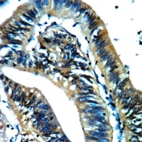 Anti-AKR1A1 Antibody