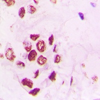 PIAS3 antibody