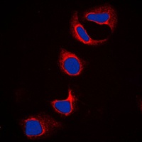 Anti-IFITM3 Antibody