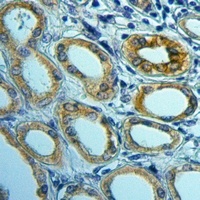 Anti-PGRMC2 Antibody