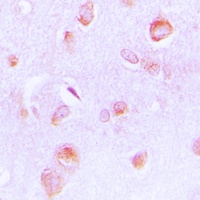 Anti-PECI Antibody