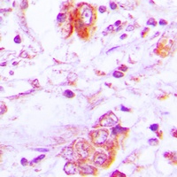 Anti-Follistatin Antibody