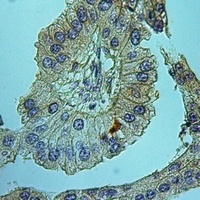 Anti-NHE6 Antibody