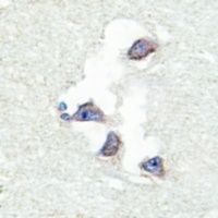 SYNCRIP antibody