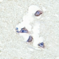 Anti-hnRNP Q Antibody