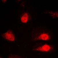 SYNCRIP antibody