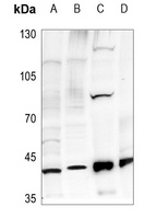 Dynactin p50 Rabbit Polyclonal Antibody