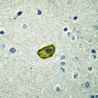 Dynactin p50 Rabbit Polyclonal Antibody