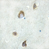 AHA1 Antibody