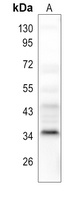 POLR3F Antibody