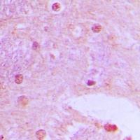 Anti-TAF6L Antibody