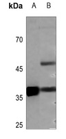 Podoplanin Antibody