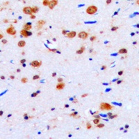 CUGBP1 Antibody