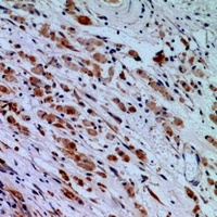 Anti-Hydrophobestin Antibody