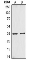 CYSLTR1 Rabbit Polyclonal Antibody