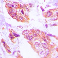 HSPH1 Antibody [KO/KD Validated]