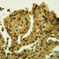Anti-FRS3 Antibody