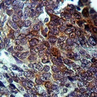 Anti-FGL2 Antibody
