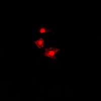 FAST Kinase Antibody