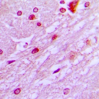 Anti-DBF4 Antibody