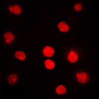 Anti-DBF4 Antibody