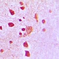 Anti-Peroxiredoxin 3 Antibody